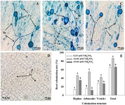 Effects of arbuscular mycorrhizal fungus inoculation on the growth and nitrogen metabolism of Catalpa bungei C.A.Mey. under different nitrogen levels